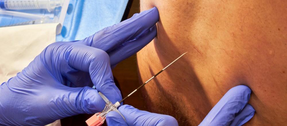A doctor's hands inserting a needle into a spine
